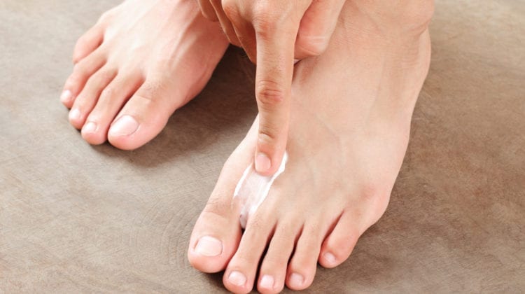 Will Athlete’s Foot Cream Work on Ringworm Organic