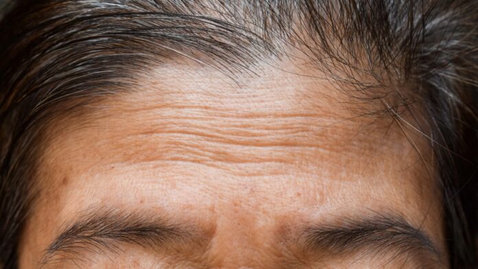 Untitled-2 (6) Wrinkle Creams - Forehead wrinkles